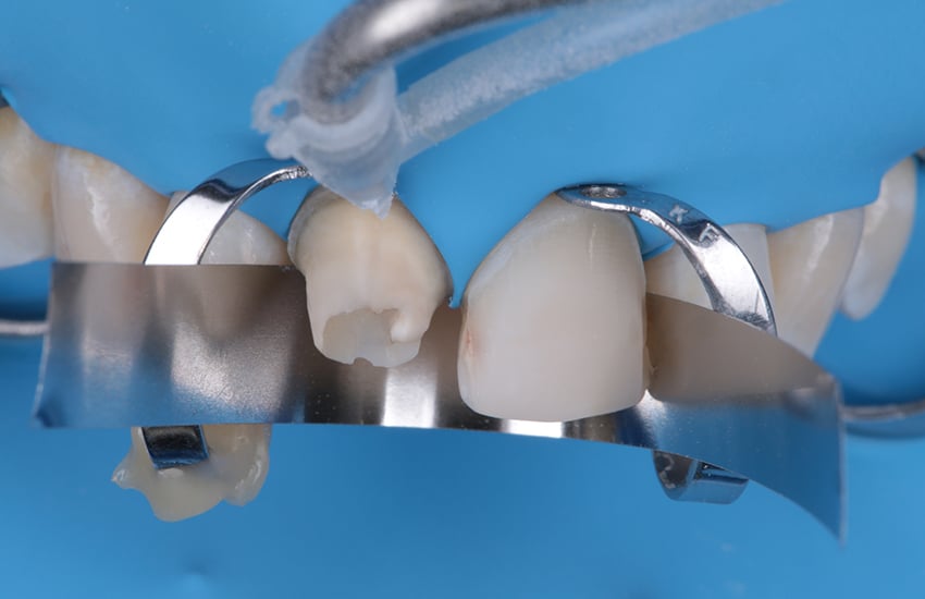 17444-Composite-sandblast-build-up-850x550