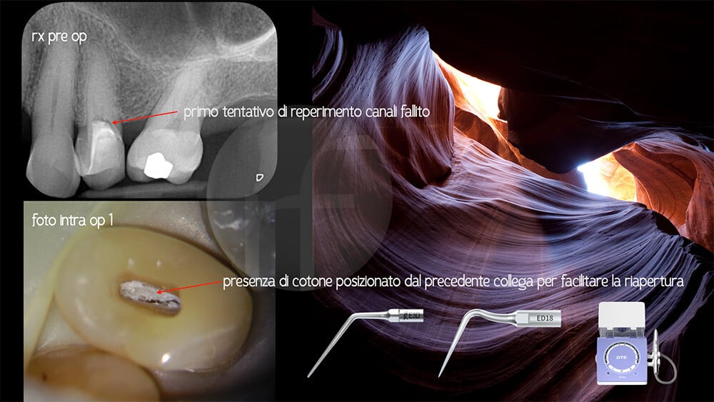 CASO_2_BLOG_DT_202402-light