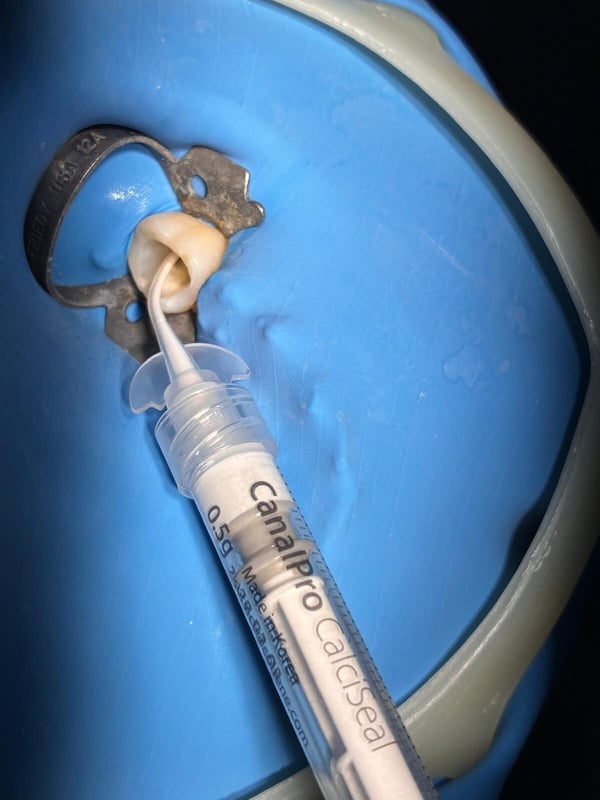 CalciSeal2_1