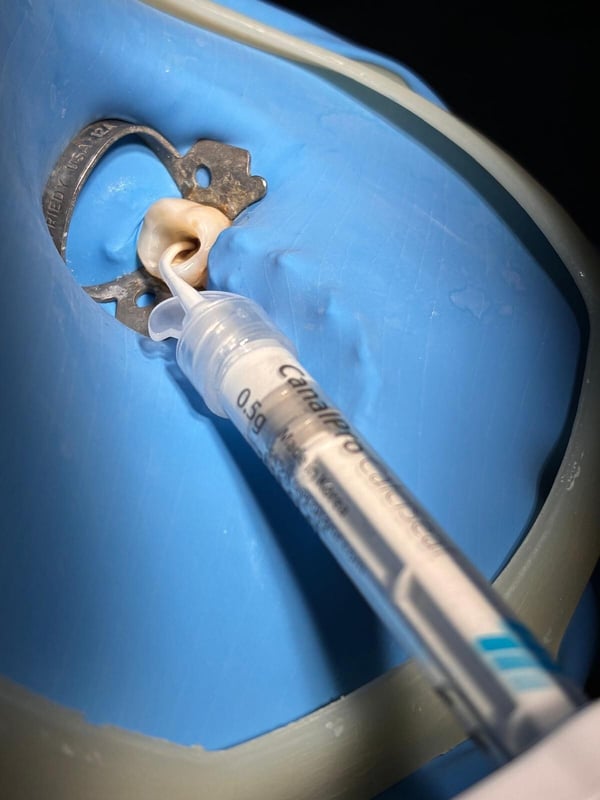 CalciSeal2_2