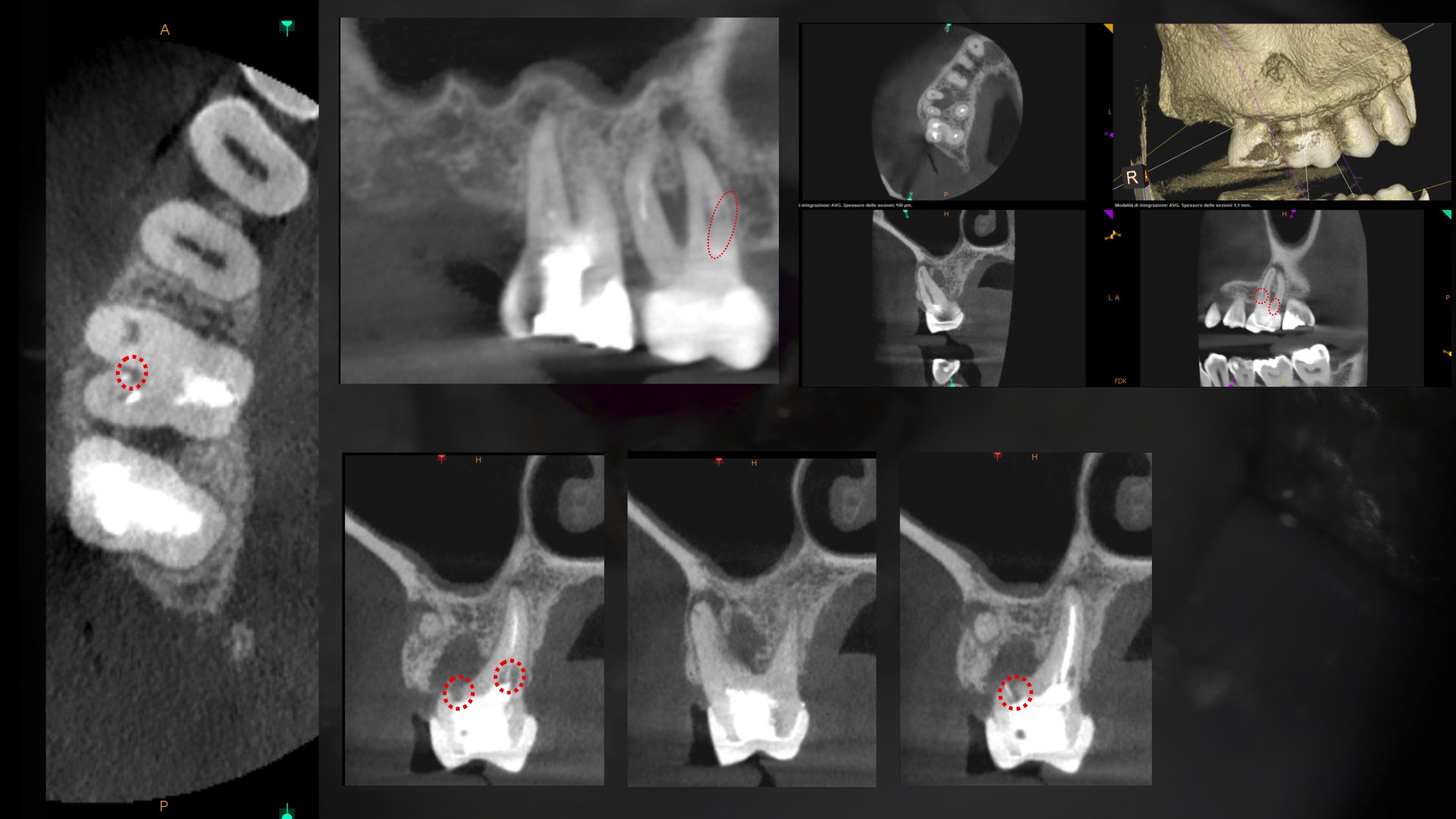 Caso Per Dental Trey.002