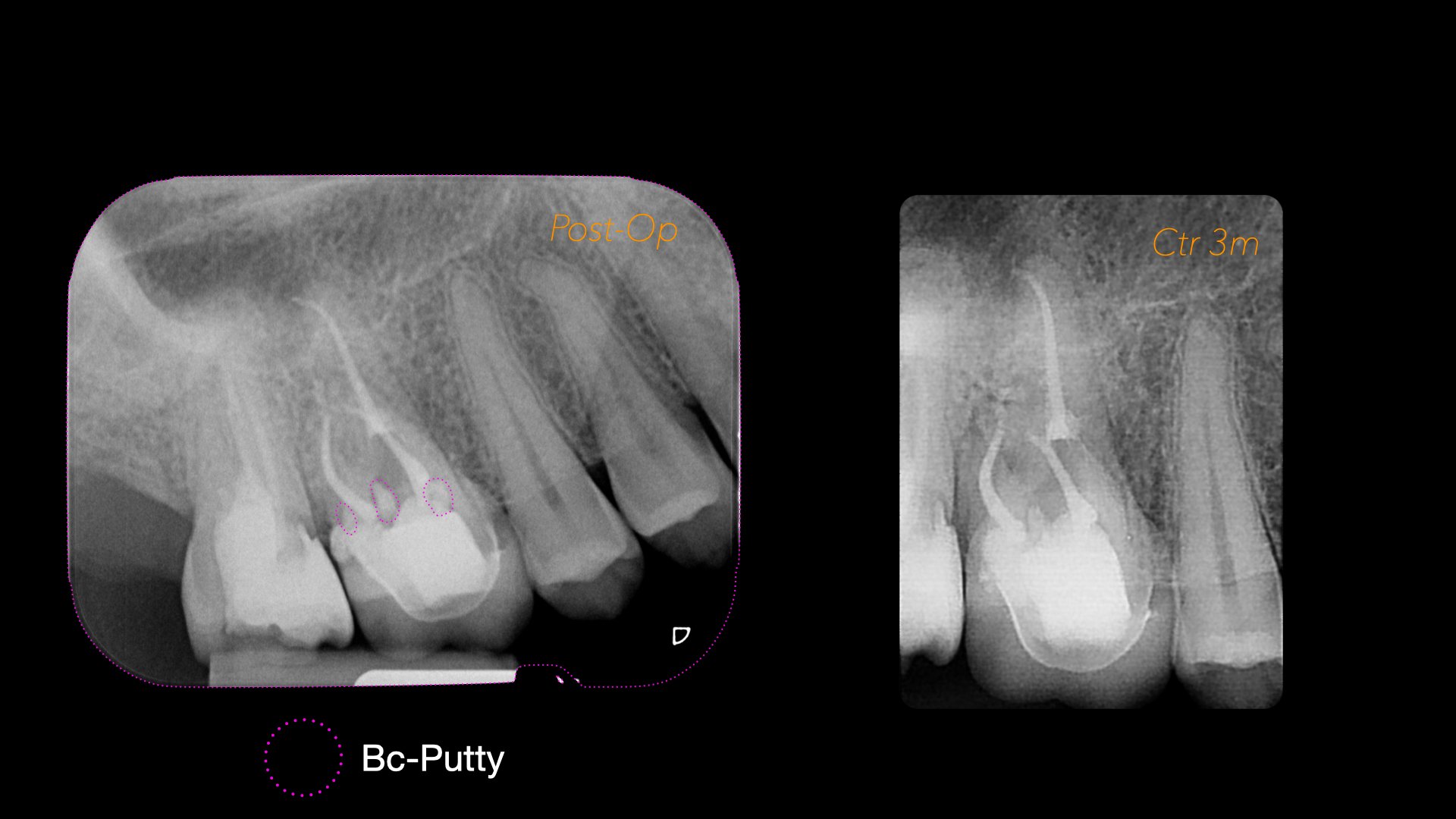 Caso Per Dental Trey.007