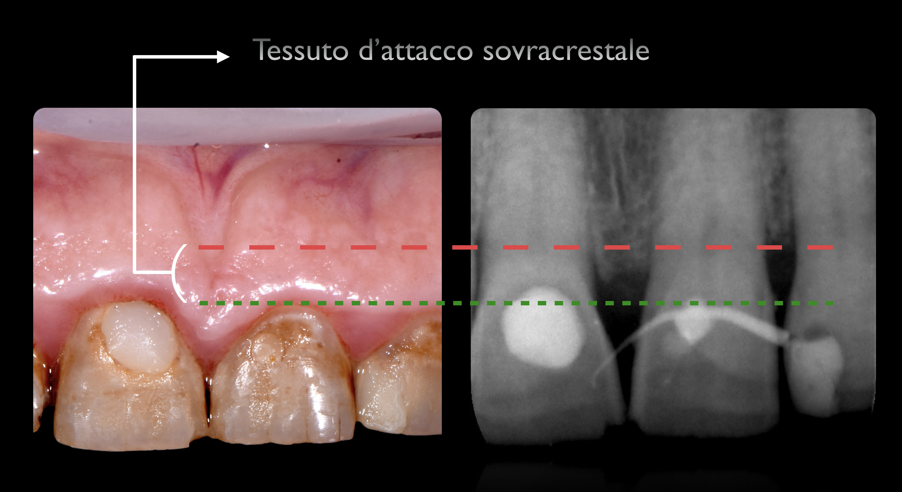 FIG.2