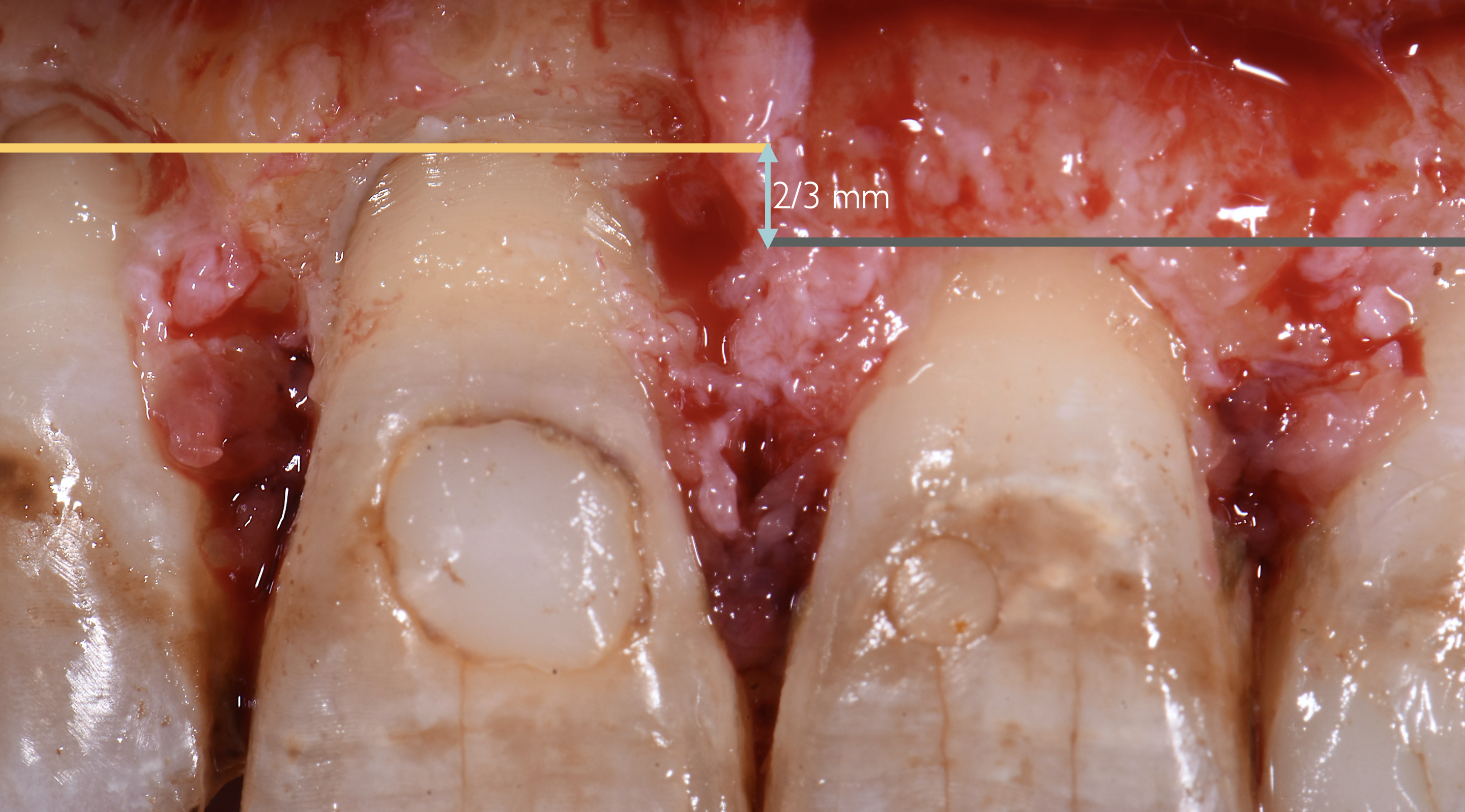 FIG.9