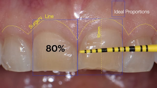 Fig 5.Correlazione con proporzioni ideali 