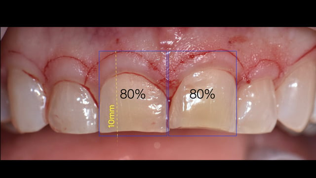 Fig 8 Fase chirugica  