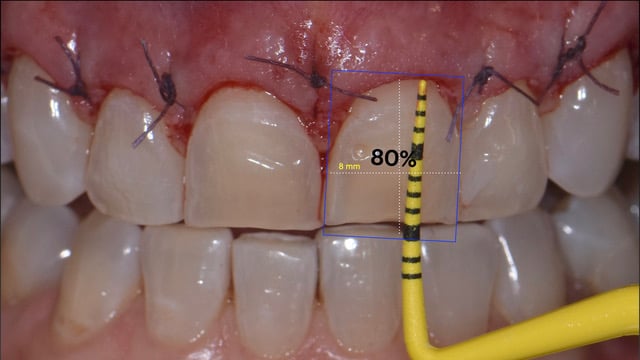 Fig. 10 analisi delle proprzioni post chirurgiche