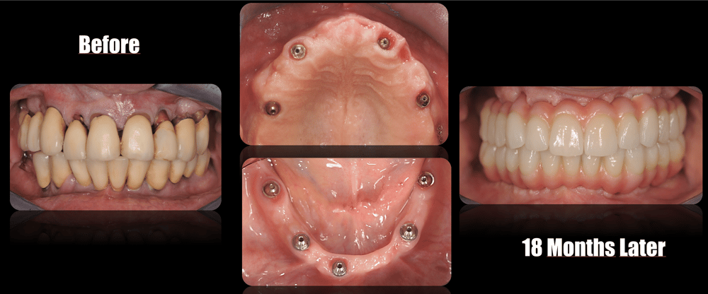 Fig.13