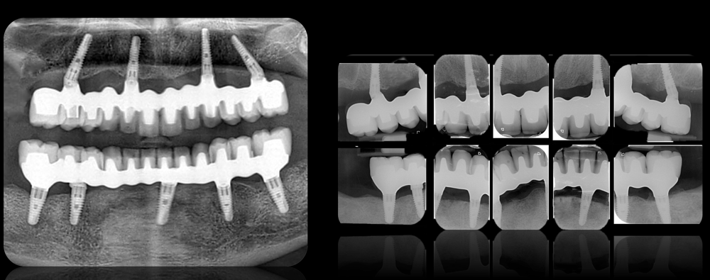 Fig.14