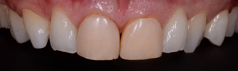 Immagini-Caso-Clinico-batt-ema-dt-12-1