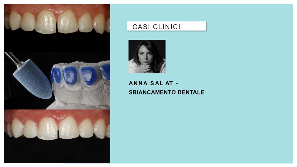 fotografia-articulo-dental-tray-blanqueamiento-marketing_009-1024x576