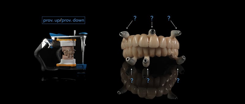 Lavorgna_Full-digital-implant-workflow-a-5-years-follow-up-22