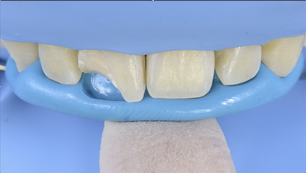 RS1119_3.silicon index