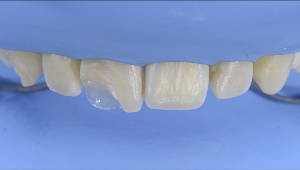 RS1120_5. palatal shell