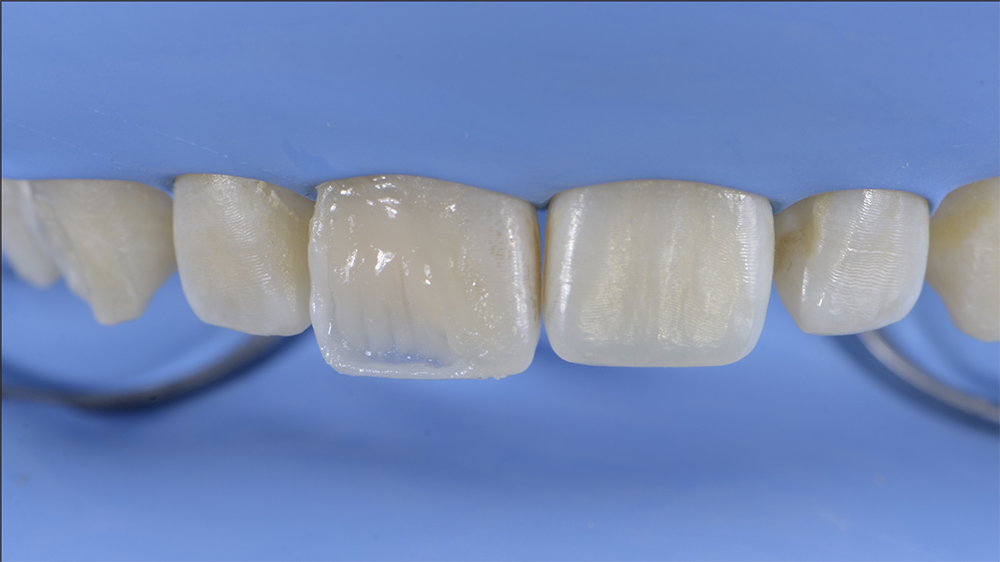 RS1122_7. dentine architecture