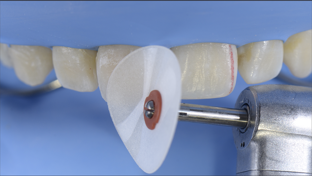 RS1124_10. finishing procedure