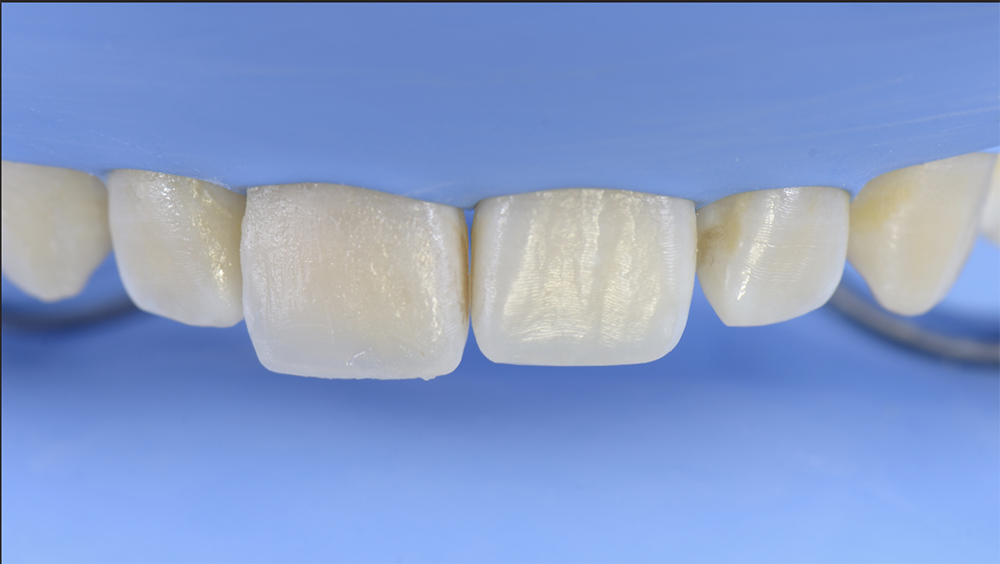 RS1126_9. before finishing