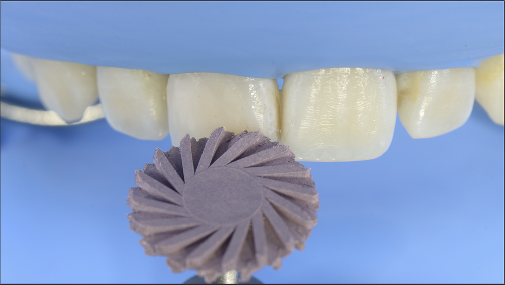 RS1128_12. polishing