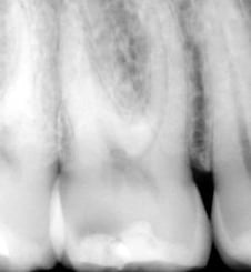 Tornabene_Articolo_Dental-Trey-2