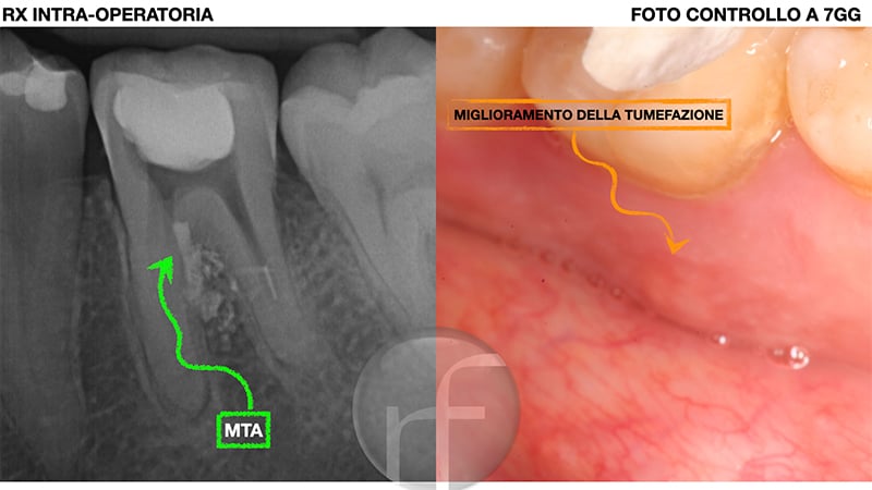 blog-DT-immagini5