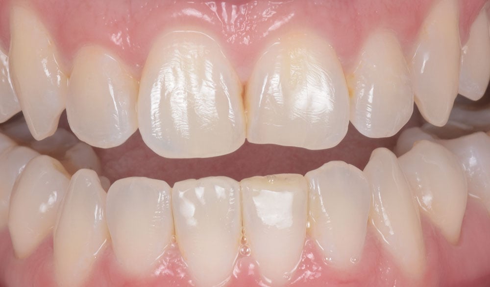 ortho-refinement-clinical01.-2