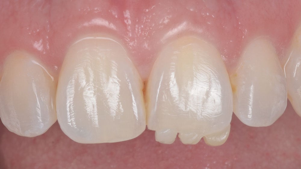 ortho-refinement-clinical02