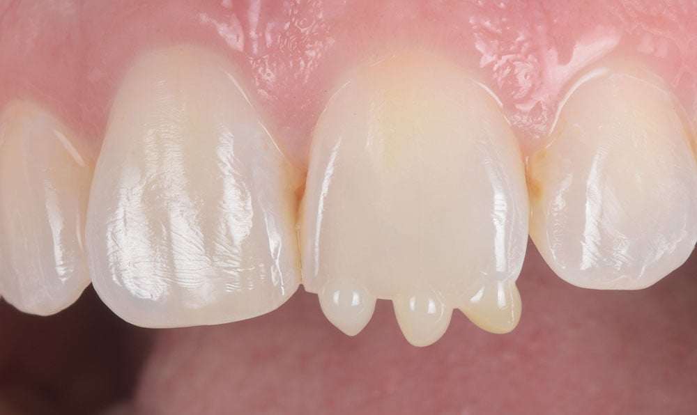 ortho-refinement-clinical03