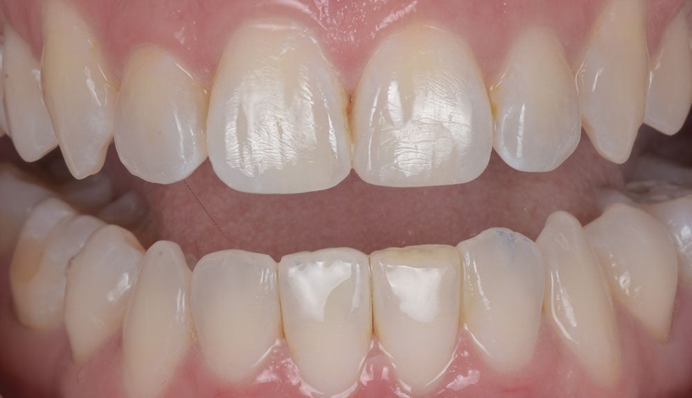ortho-refinement-clinical04