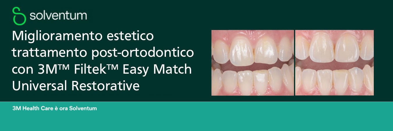 Miglioramento estetico trattamento post-ortodontico con 3M™ Filtek™ Easy Match Universal Restorative
